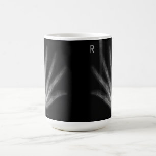 Extra Digit X-ray Right & Left Hands Coffee Mug
