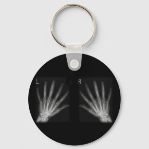 Extra Digit X-ray Right & Left Hands Key Ring