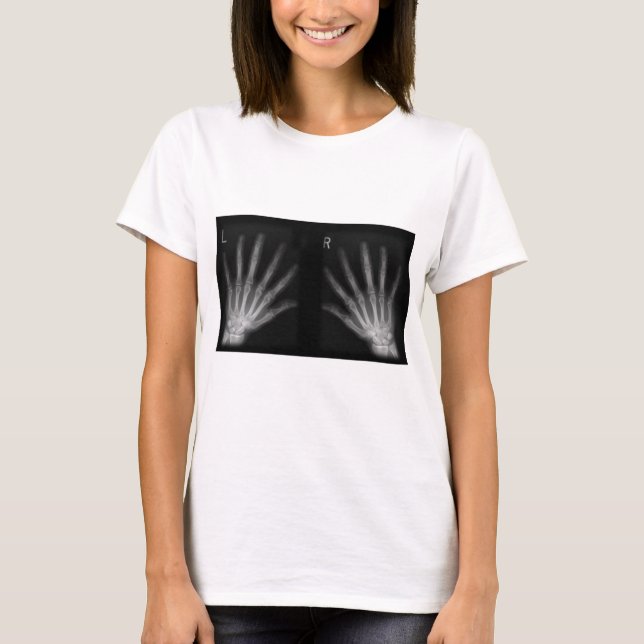 Extra Digit X-ray Right & Left Hands T-Shirt (Front)