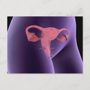 Female Reproductive Organ, X-Ray View 2 Postcard