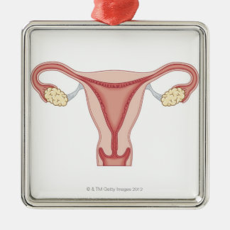 Female Reproductive System 2 Metal Tree Decoration