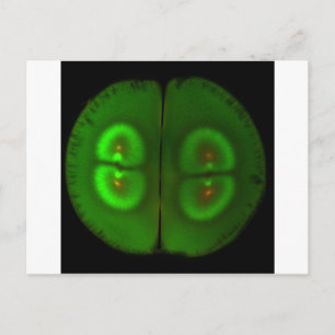 Fertilised frog egg postcard