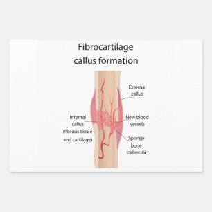 Fibrocartilage Callus formation Wrapping Paper Sheet