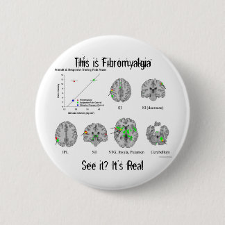 Fibromyalgia is real. fMRI proof 6 Cm Round Badge
