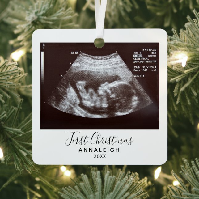 First Christmas Pregnancy Ultrasound Photo Holiday Metal Tree Decoration (Insitu)