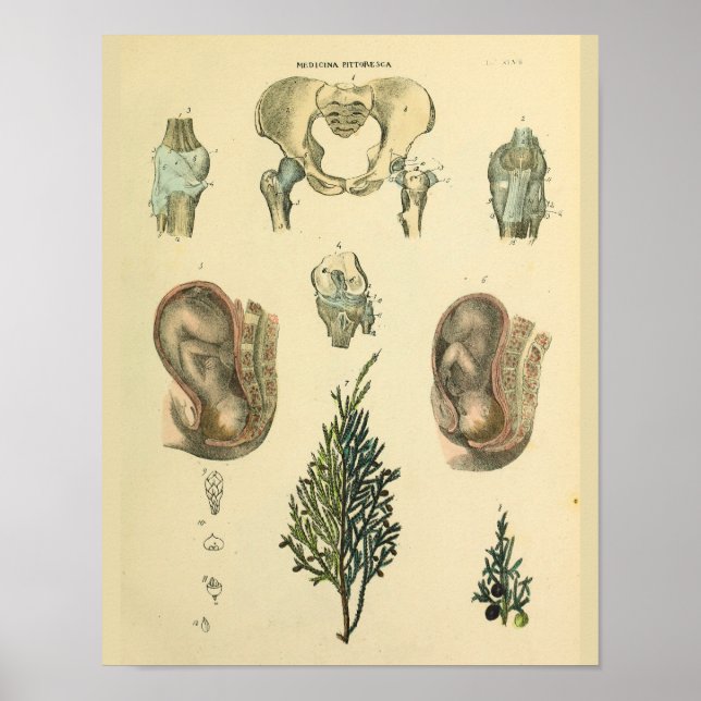 Foetal Position Pelvis Anatomy Vintage Art Print (Front)