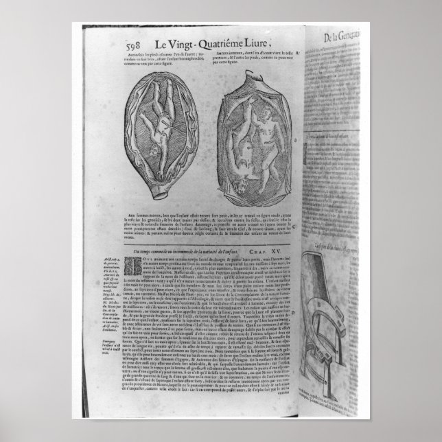 Foetus, illustration from 'Oeuvres' Poster (Front)