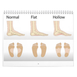 Foot deformity types calendar
