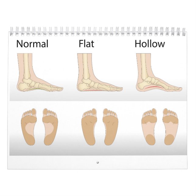 Foot deformity types calendar (Cover)