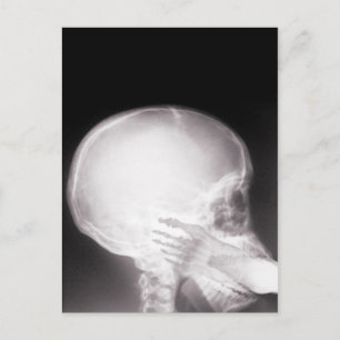 Foot in Mouth X-Ray Postcard