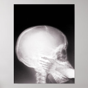 Foot in Mouth X-Ray Poster
