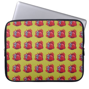 Fruit Patterns Strawberries on gold Electrinics Laptop Sleeve