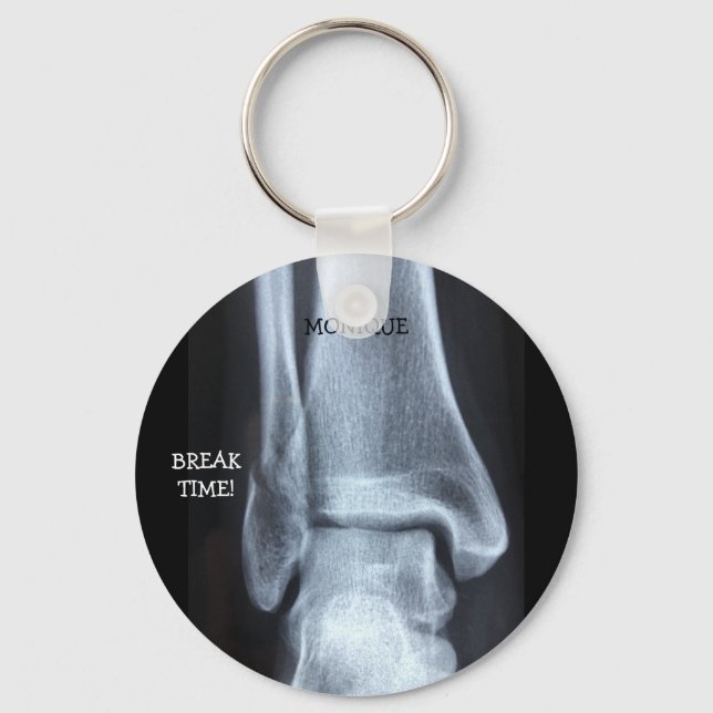 Funny Broken Fibula Xray "Break Time"    Key Ring (Front)