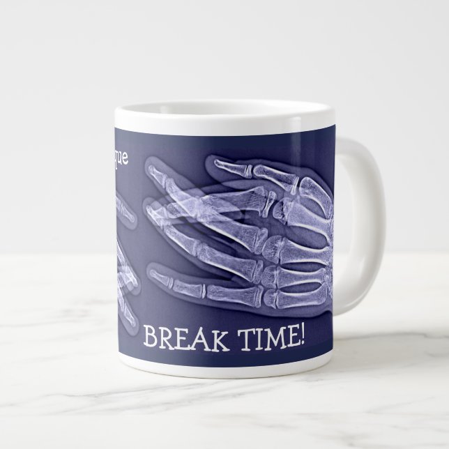 Funny Broken Finger Xray "Break Time" Large Coffee Mug (Front Right)