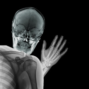Funny Xray Accessories | Zazzle.com.au