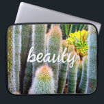 Fuzzy Green Cacti Succulent Photo Beauty Script Laptop Sleeve<br><div class="desc">Cacti thrive in the harshest of desert conditions. Dream of sunny days and the beauty of a summer’s garden whenever you use this stunning photography neoprene laptop sleeve. This laptop sleeve comes in three sizes: 15", 13", and 10”. Makes a great gift for someone special! You can easily personalise this...</div>