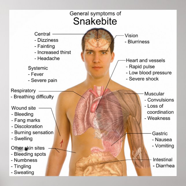 General Symtoms Chart of a Snakebite Poisoning (Front)