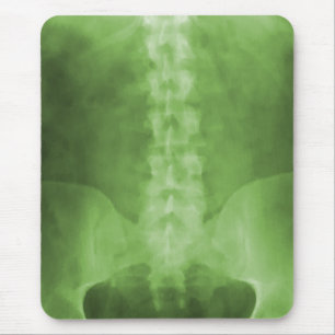 Green Digital X-Ray Art Mousepad