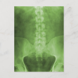 Green Digital X-Ray Art Postcards