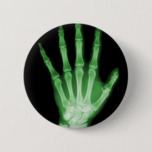 Green X-ray Skeleton Hand 6 Cm Round Badge