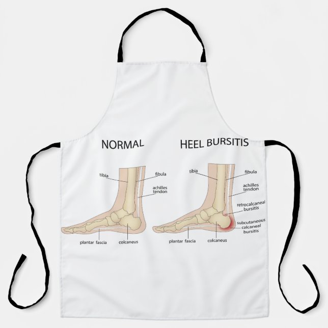 Haglund's deformity apron (Front)