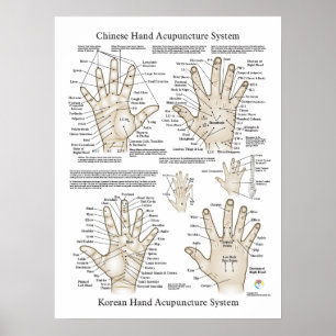 Hand Acupuncture Points Therapy Poster