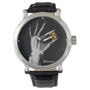 Hand Holding a Radiation Symbol    Watch