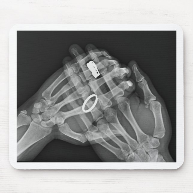 Hand Holding Mouse Pad (Front)