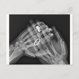 Hand Holding Postcard