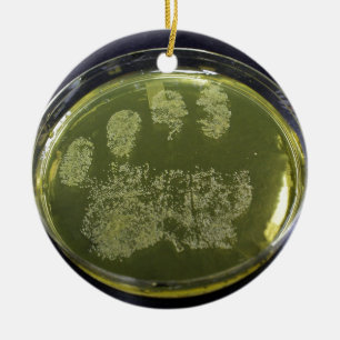 Hand Petri Dish Bacteria Ceramic Tree Decoration