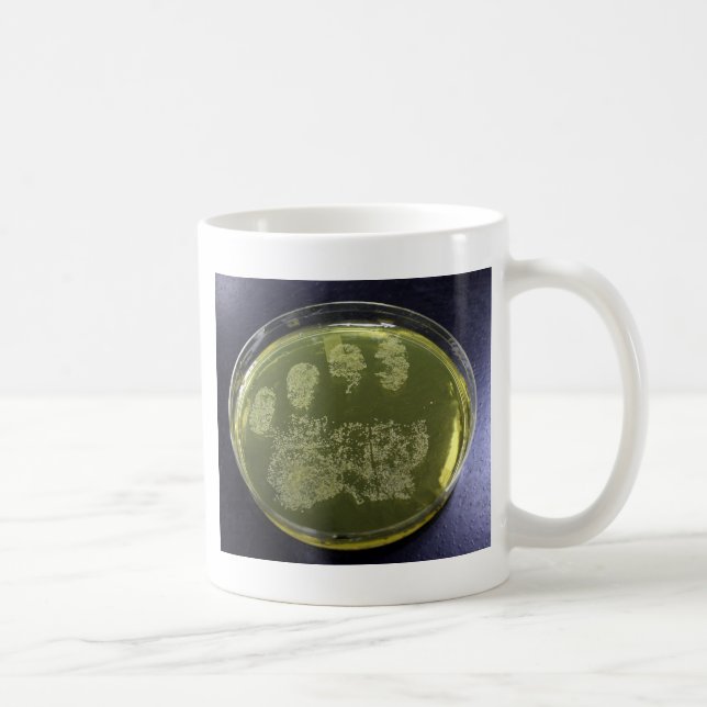 Hand Petri Dish Bacteria Coffee Mug (Right)
