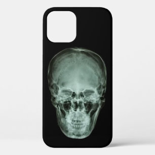 Head Skull X-Ray iPhone 12 Case