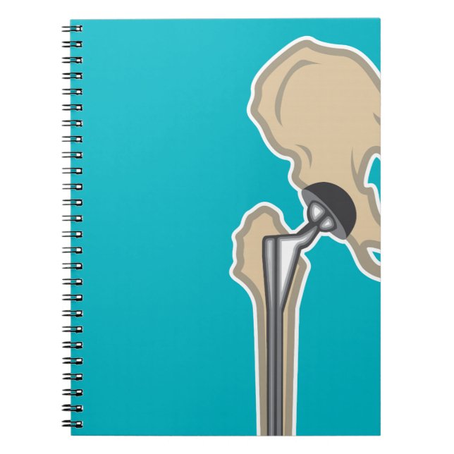 Hip Joint Replacement Notebook (Front)