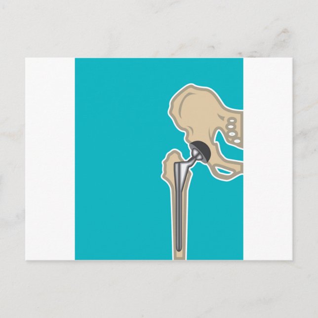 Hip Joint Replacement Postcard (Front)