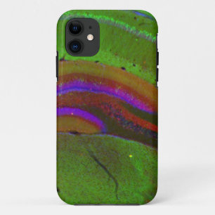 Hippocampal neurons iPhone 11 case