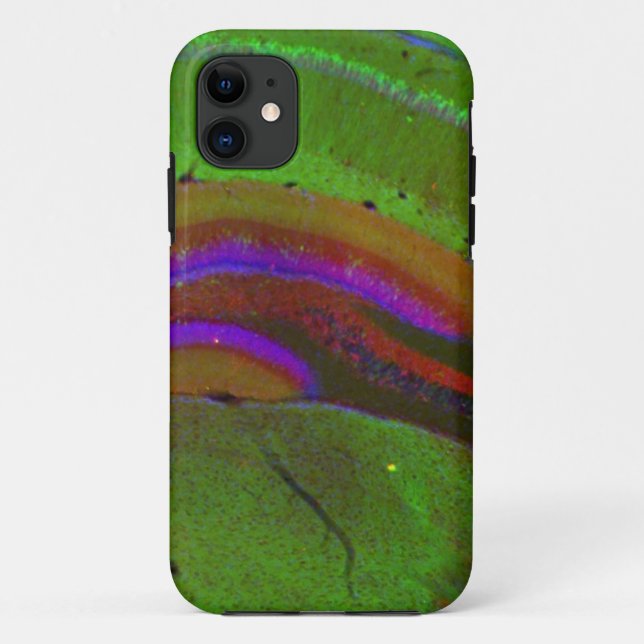 Hippocampal neurons Case-Mate iPhone case (Back)