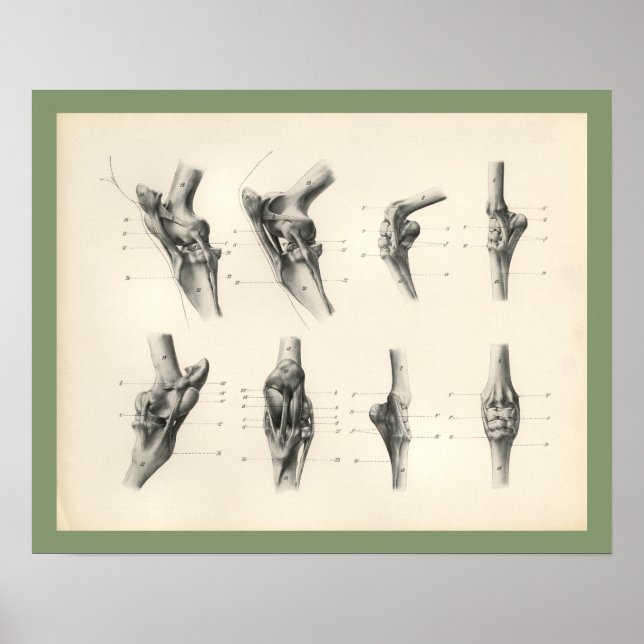 Horse Leg Bones Joints Veterinary Anatomy Print (Front)
