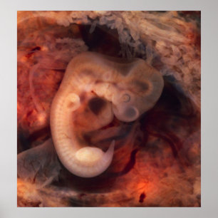 Human Embryo 7th Week of Pregnancy 5th Peek P.O. Poster