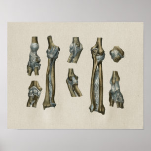 Human Joint Anatomy Vintage Print