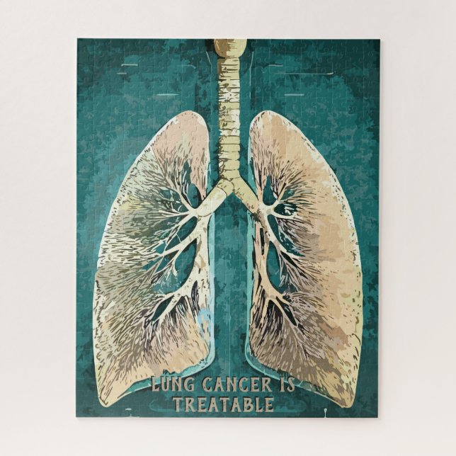 Human Lungs Jigsaw Puzzle (Vertical)