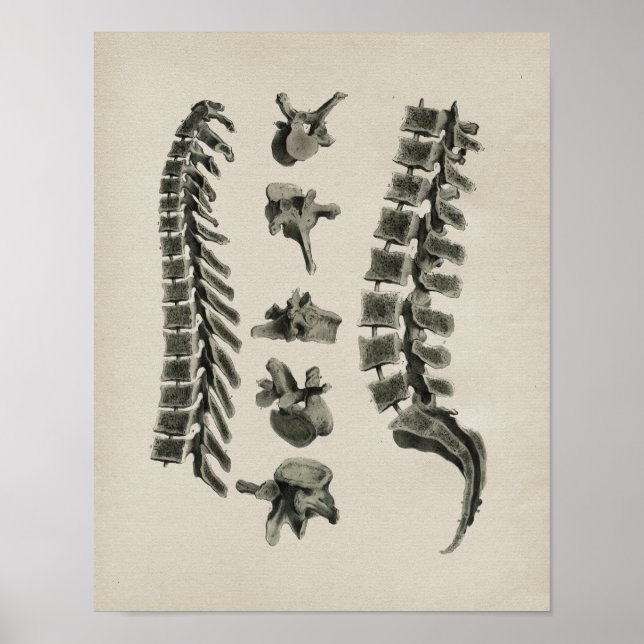 Human Spine Anatomy Vintage Print (Front)
