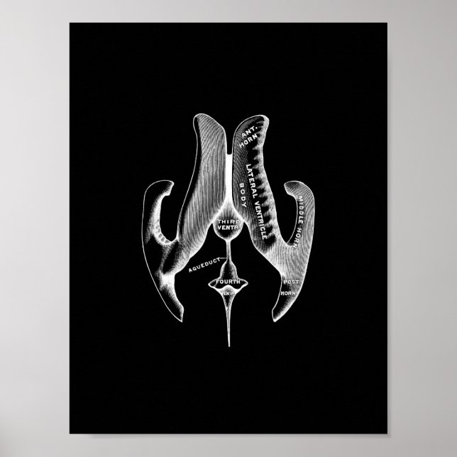 Human Ventricles Anatomy in Black and White Print (Front)