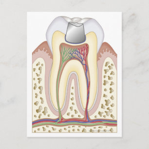 Illustration of Dental Filling Postcard
