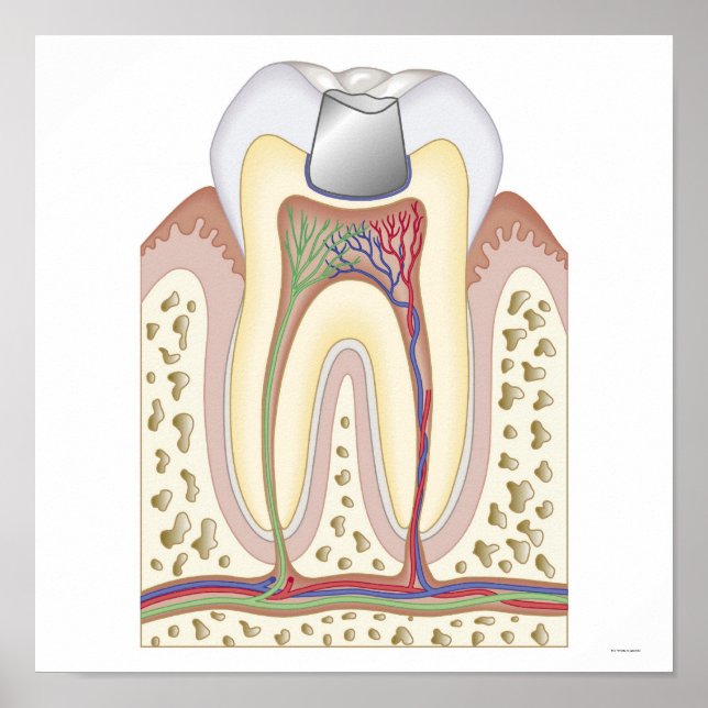 Illustration of Dental Filling Poster (Front)
