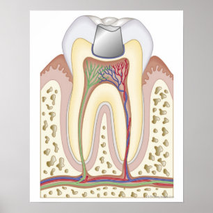 Illustration of Dental Filling Poster