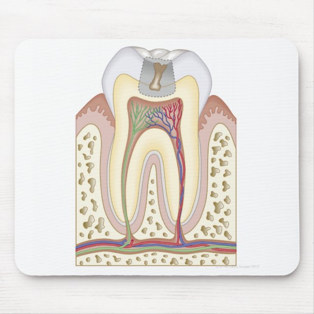Illustration of Tooth Decay Mouse Pad (Front)