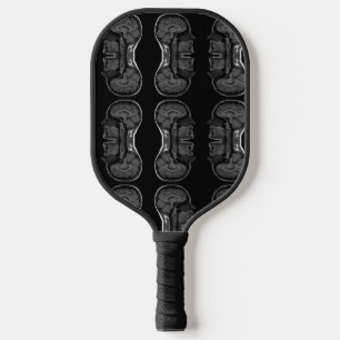 im in your head xray mri scan medical pickleball paddle