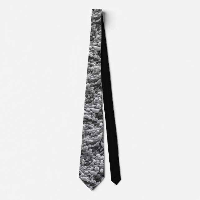 Iris melanoma (life in disorder) tie (Front)