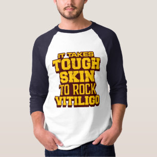 It takes tough skin to rock vitiligo T-Shirt