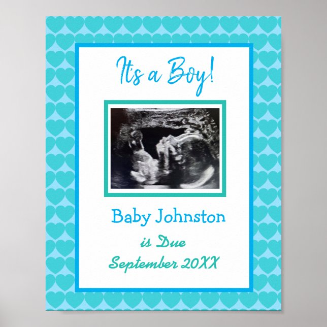 It's a Boy, Pregnancy Announcement Ultrasound Pic Poster (Front)